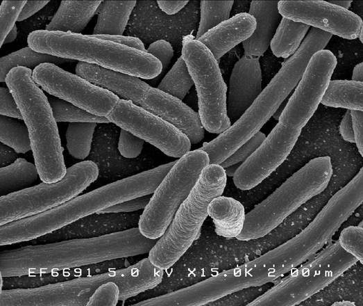 E. Coli: nella Malattia di Crohn può essere legato alla spondiloartrite