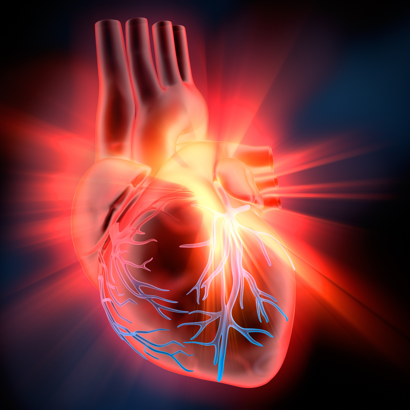 PCI e bypass: le soluzioni migliori nell’infarto con shock cardiogeno