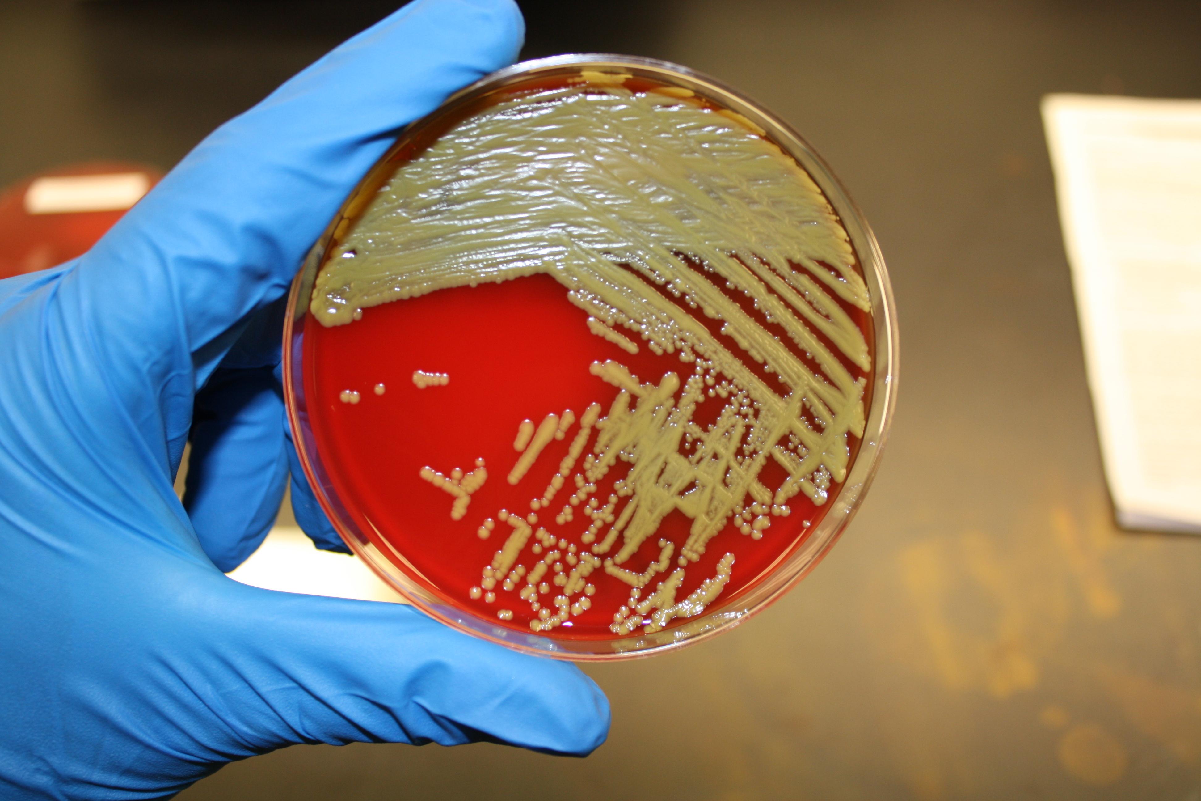 In 5 anni +57% incidenza infezioni da Enterobacterales resistenti ai carbapenemi. Ecdc: “Grave rischio per sanità europea”