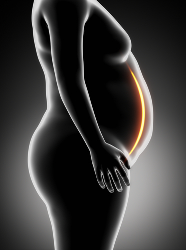 Tumore prostatico nella razza nera: la chiave è l’obesità?