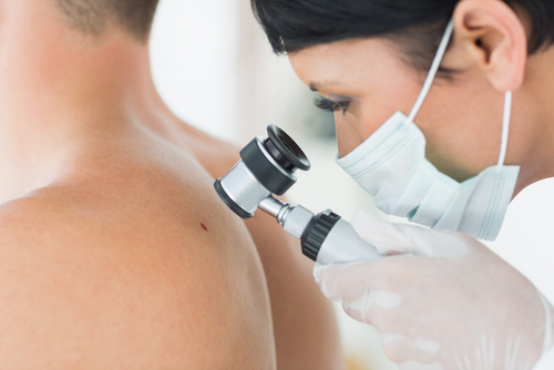 Melanoma: utile ipilimumab per il trattamento adiuvante?