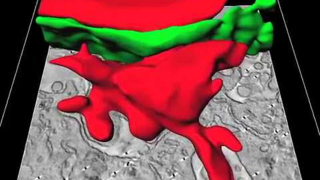 Visti ‘in diretta’ linfociti attaccare l’epatite B