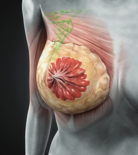 Tumori mammari metastatici HER2-positivi, un nuovo standard di cura