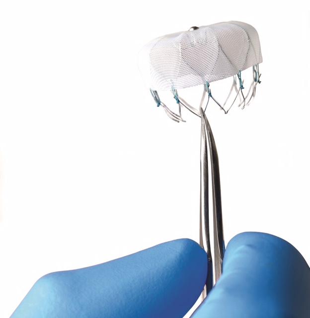 Dispositivo WATCHMAN: soluzione innovativa per ridurre il rischio di ictus