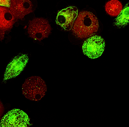Artrite reumatoide: cellule dendritiche sopprimono la disfunzione immunitaria