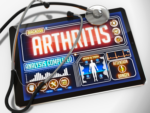 Artrite psoriasica: arriva l’app ad hoc
