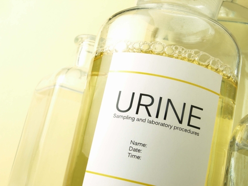 Abuso esami delle urine espande prescrizioni antibiotici negli anziani