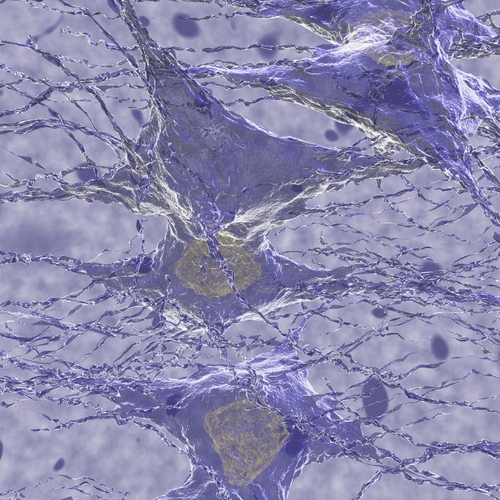 Glioma pediatrico: la sopravvivenza differisce fra i sessi