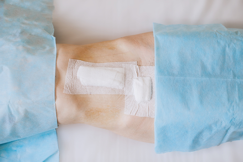 Ernie: rete di riparazione biologica costosa e non necessaria