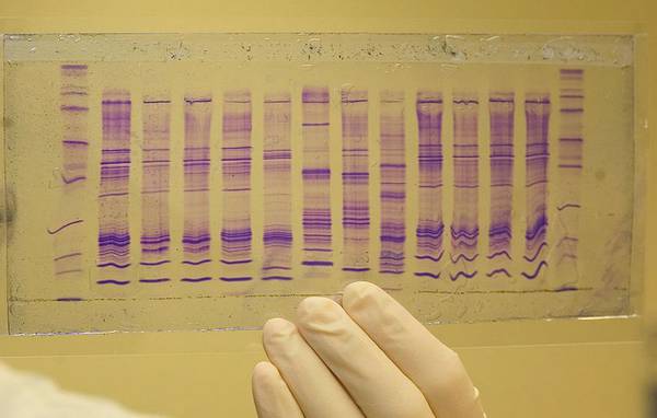 Tumori polmonari non a piccole cellule: cellule tumorali circolanti come biomarcatore