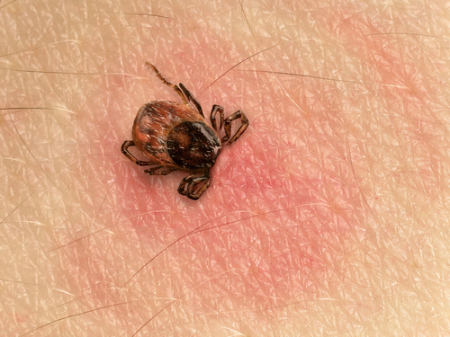 Verso un vaccino per la borreliosi di Lyme