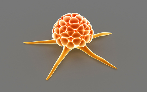 Tumori: disturbi mentali comuni anche prima della diagnosi