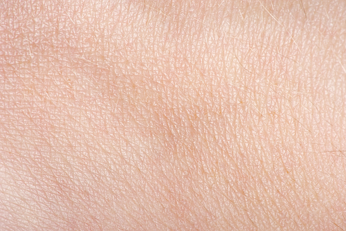 Melanoma: meno della metà degli studi considera il colore della pelle