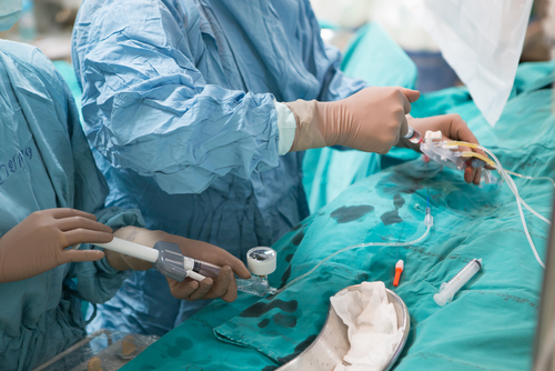 Leucemia: l’angioplastica coronarica può aumentare il rischio