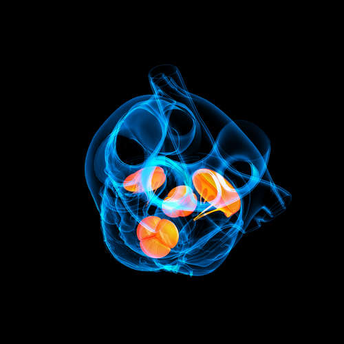 TAVR: sopravvivenza migliore nelle donne