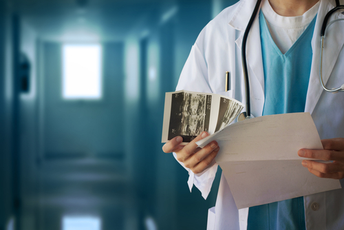 Attacchi di cuore: la mammografia potrebbe prevenirli