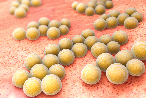Staphylococcus aureus: aumenta la resistenza alla clindamicina