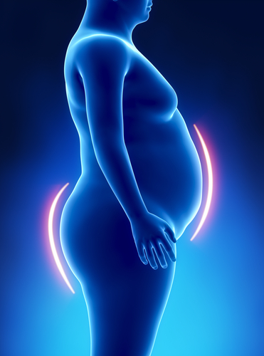 Reflusso e chirurgia bariatrica: ecco la situazione attuale