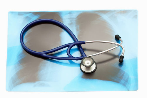 Pneumologia interventistica: a Firenze congresso mondiale dall’8 all’11 maggio