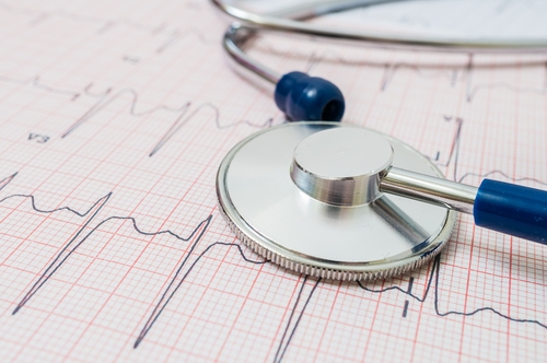 Cuore, ANMCO: in Italia morti evitabili con screening aggiornati. No a ECG low cost