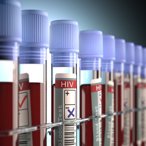 Al via il progetto EPIICAL, per sconfiggere l’HIV pediatrico