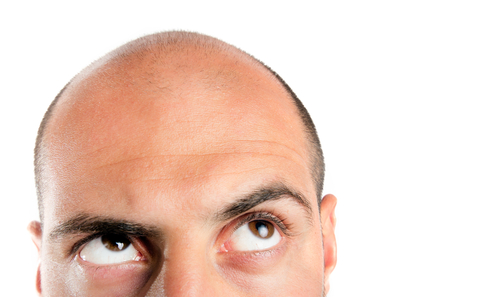 Alopecia totalis: dupilumab stimola ricrescita dei capelli