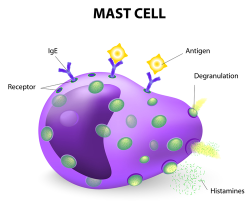 Carcinoma squamoso della testa e del collo: ruolo dei mastociti