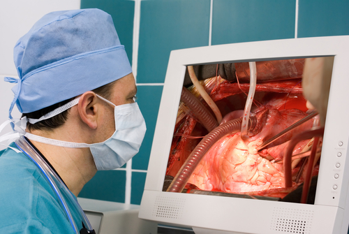 Chirurgia bariatrica: non tutti i chirurghi sono uguali