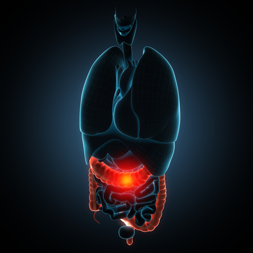 Ruolo dei fattori ambientali nelle IBD