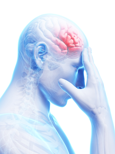 Afasia post-ictus e barriere linguistiche: impatto sulla riabilitazione