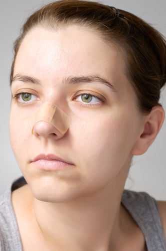 Ostruzioni nasali: mollette e dilatatori alternativa a intervento chirurgico