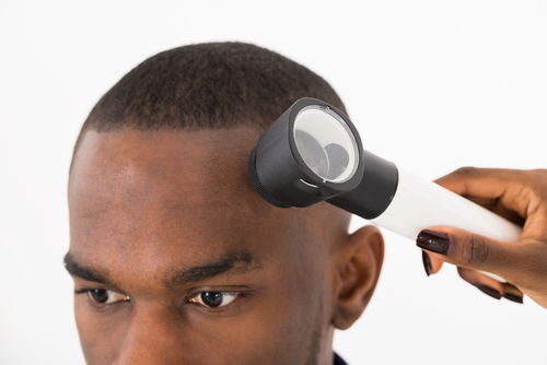 Melanoma: tra gli afro-americani è meno comune, ma è spesso letale