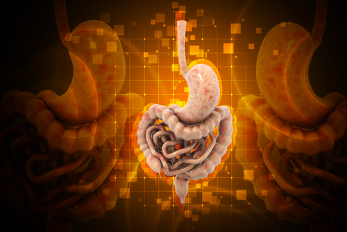 Trattamento dell’adenocarcinoma gastrico o gastroesofageo in stadio avanzato CLDN18.2 positivo: efficacia e sicurezza di zolbetuximab e chemioterapia