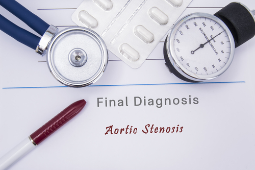 Individuata relazione tra psoriasi e stenosi della valvola aortica