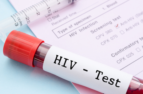 HIV: diffusione dei test di diagnosi dell’infezione tra gli studenti in Polonia