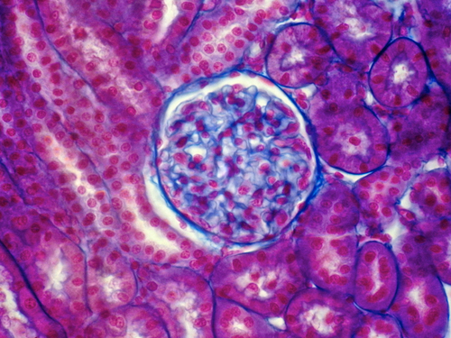 Inibitore di due cascate contro le patologie glomerulari