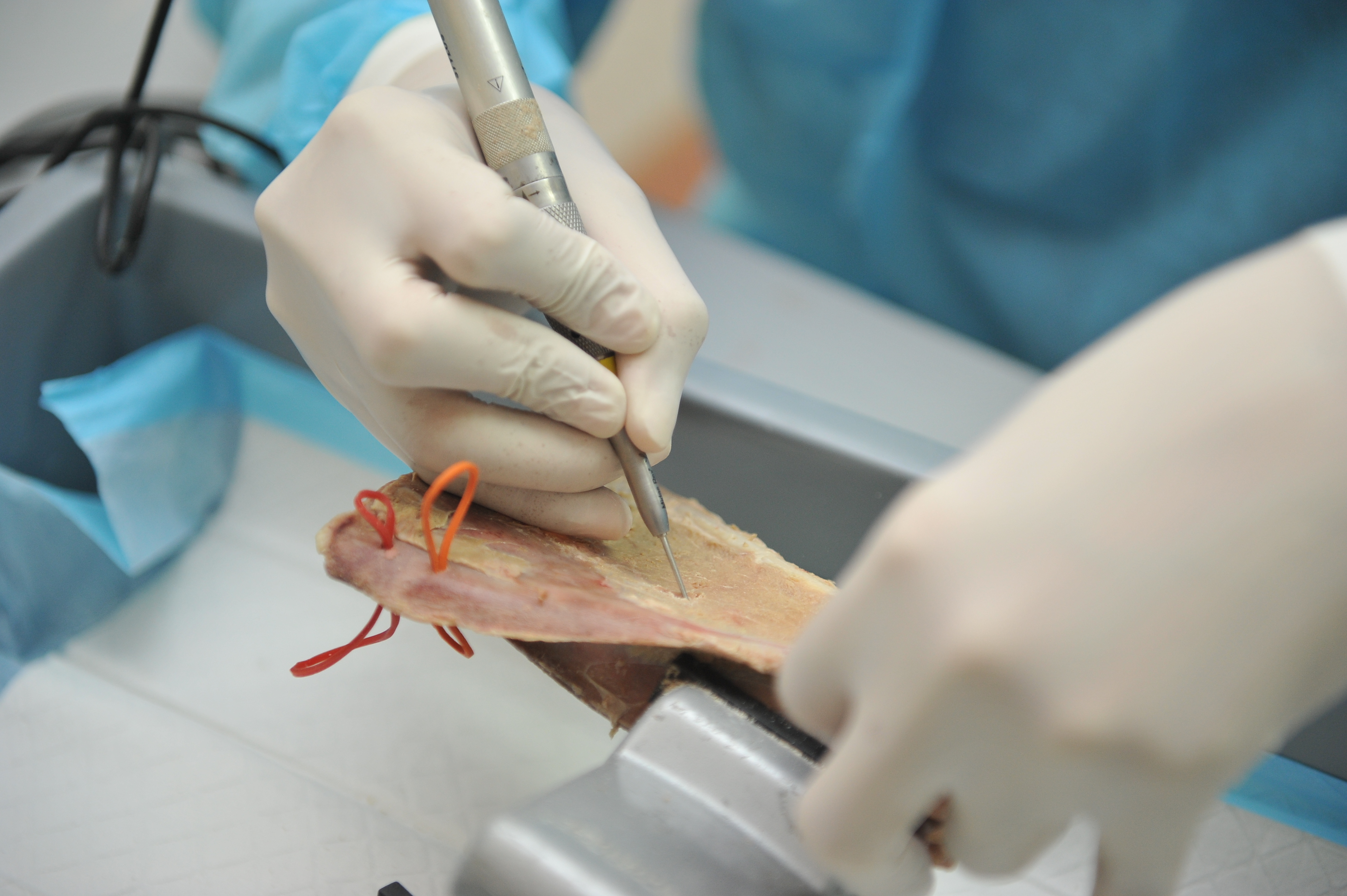 Chirurgia maxillo-facciale: da stampanti 3D modelli simili a quelli commerciali