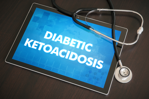 Chetoacidosi diabetica: frequenti nefropatie acute nei bambini