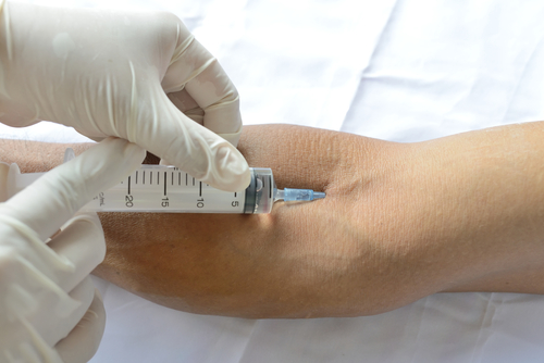 Derivazioni endovenose: come ridurre il dolore nei bambini