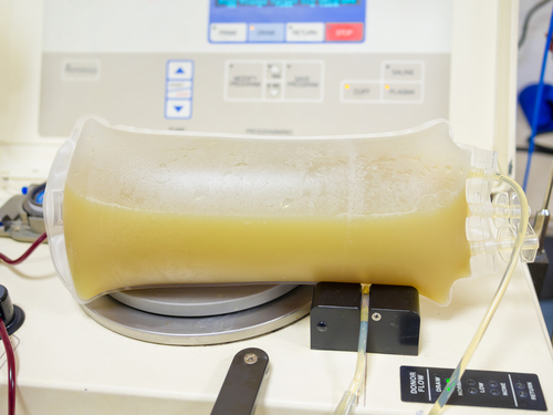 Tempesta tiroidea: la plasmaferesi precoce potrebbe aiutare alcuni pazienti