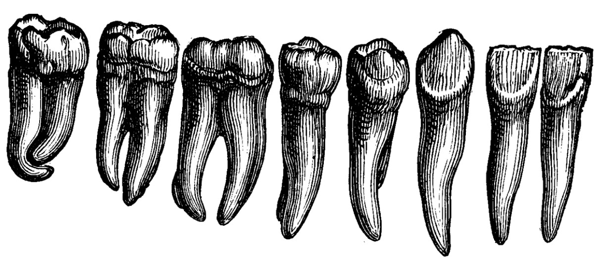 Perdita dei denti come parametro complesso di patologia orale