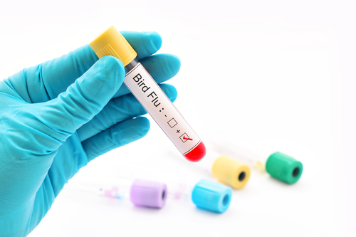 Vaccino a nanoparticelle lipidiche di mRna contro l’influenza aviaria