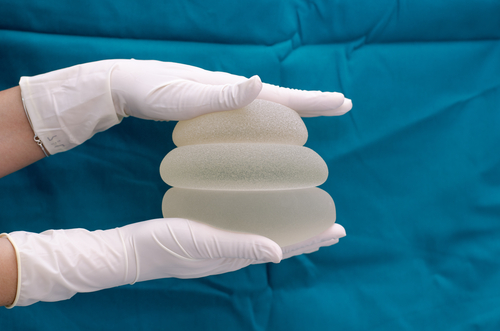 Correlazione tra impianti mammari e carcinoma squamocellulare: uno studio approfondito e le implicazioni per la gestione clinica