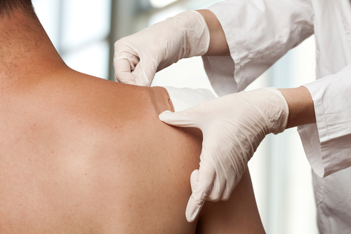 Vaccini: il futuro è nella patch microneedle?