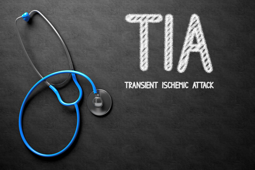 TIA: maggiori livelli piastrine rivestite connessi ad aumento rischio ictus