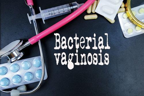 Hiv: efficace la profilassi preespositiva nelle donne con anomalie della flora vaginale