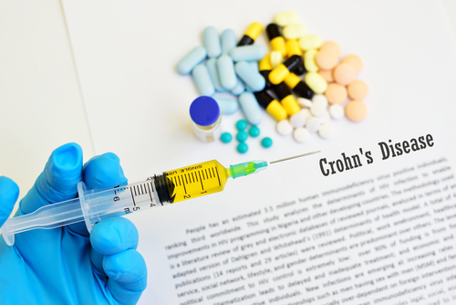 Crohn: chirurgia valida alternativa a infliximab
