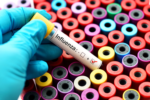 Influenza: diagnosi più accurate con i nuovi test immunologici rapidi
