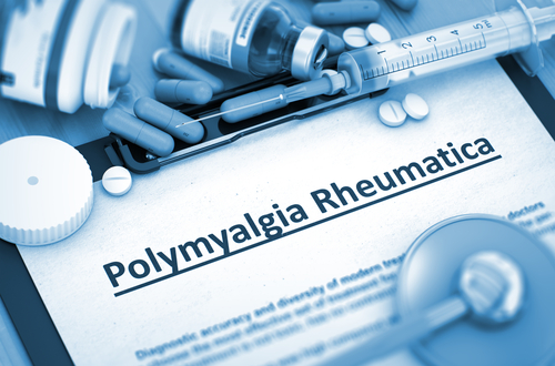 Polimialgia reumatica: diagnosi e gestione