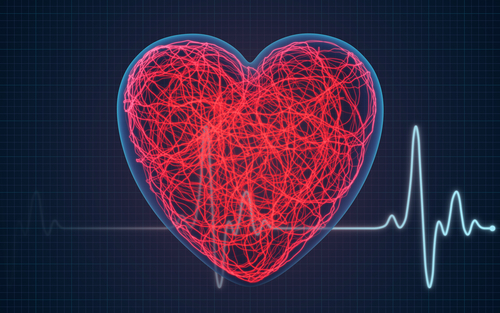 MPS I e manifestazioni cardiache